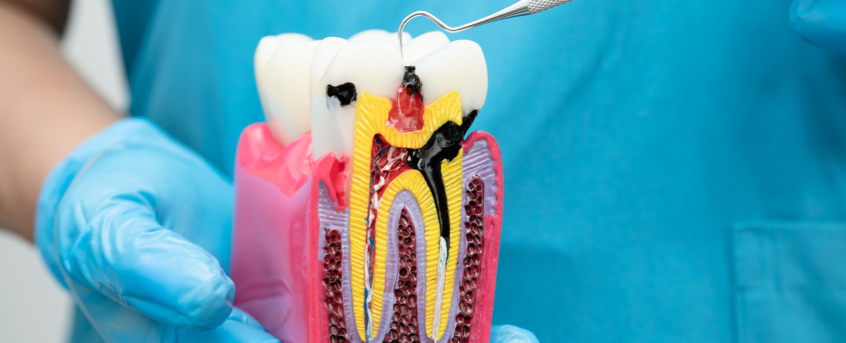 Endodontics Dental Practice