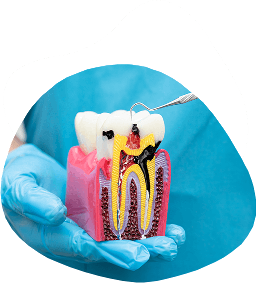 Optimal Dentistry Endodontics Service
