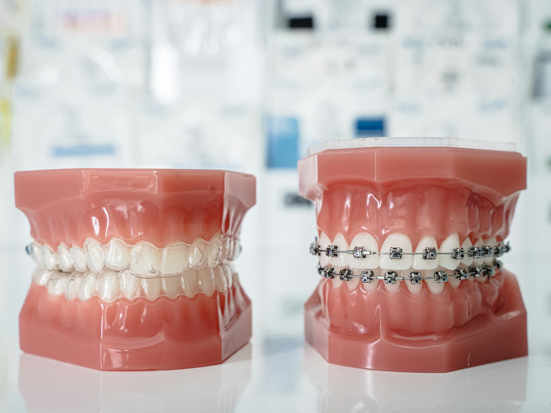 Dental models comparing traditional braces vs Invisalign aligners